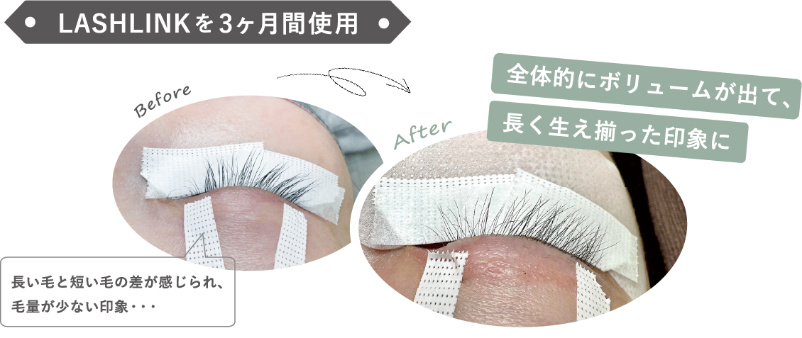 アイケア LASHLINK EYELASH SERUM LASH LINK EYELASH SERUM LASH LINK ラッシュ リンク アイ