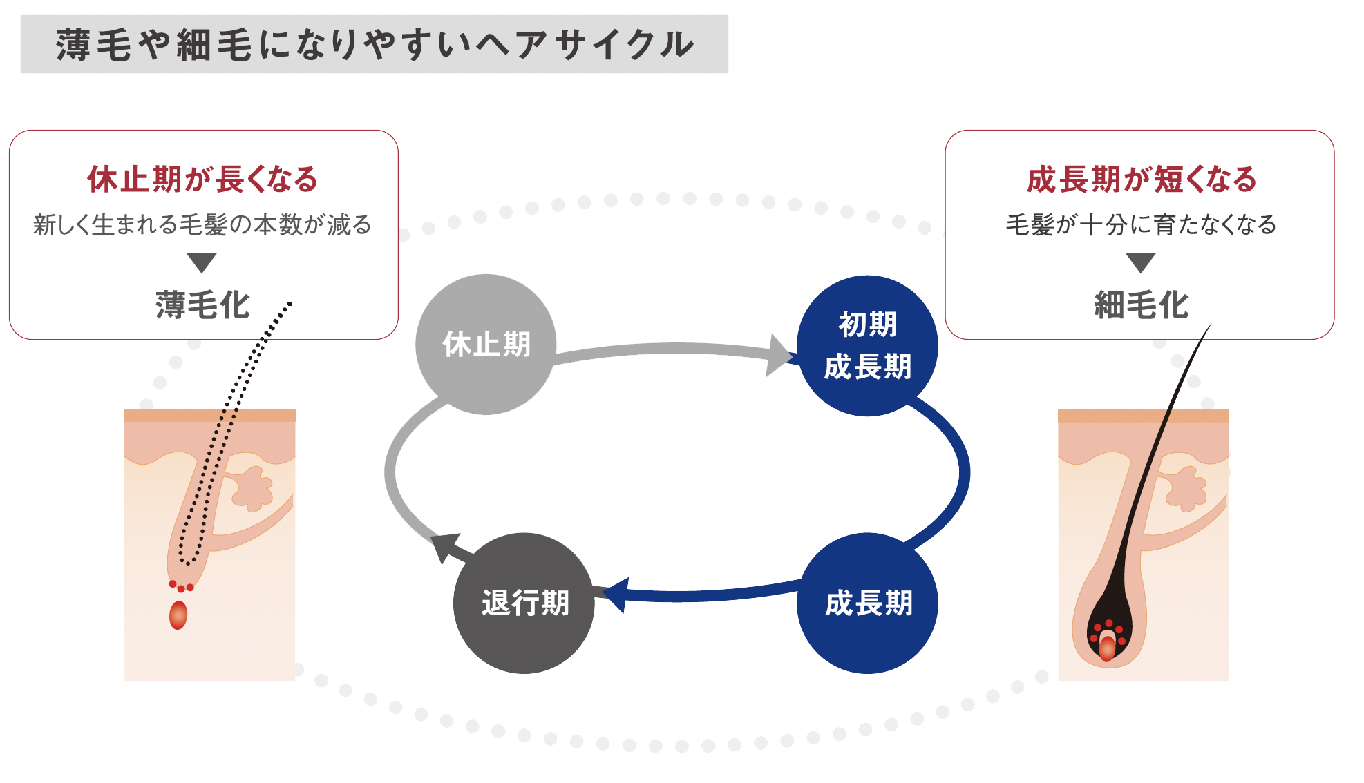 資生堂　プロフェッショナル　ザ・ヘアケア　アデノバイタル　アドバンスト スカルプエッセンス　薄毛や細毛になりやすいヘアサイクル　退行期・休止期：休止期が長くなる　新しく生まれる毛髪の本数が減る→薄毛化　初期成長期・成長期：成長期が短くなる　毛髪が十分に育たなくなる→細毛化